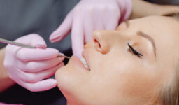 Dental Fillings: How to Know If You Need to Replace Them