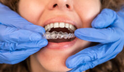 Know About Pros and Cons of Invisalign Braces